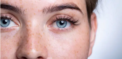 Laser Eye Surgery Cost in Adelaide, SA’ What You Need to Know Before Booking Your Procedure